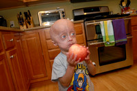 Don Campbell / H-P staff
Cameron Howard, 4, eats a snack Wednesday, September 22, 2010, at his Stevensville home. Cameron has progeria, a rare genetic condition in which children age prematurely.